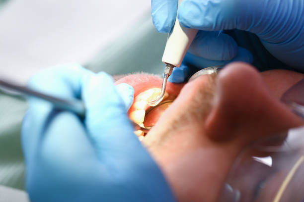 Best Chipped Tooth Repair Near Me  in Goodland, KS