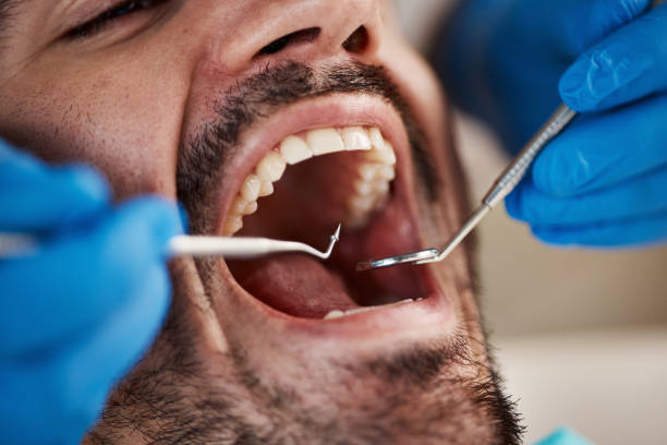 Best Emergency Tooth Extraction  in Goodland, KS